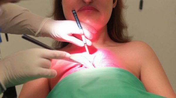 Chirurgie bariatrique : comment surmonter la grossophobie